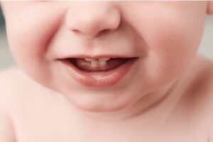 Dấu hiệu trẻ mọc răng sữa và cách chăm sóc răng cho bé
